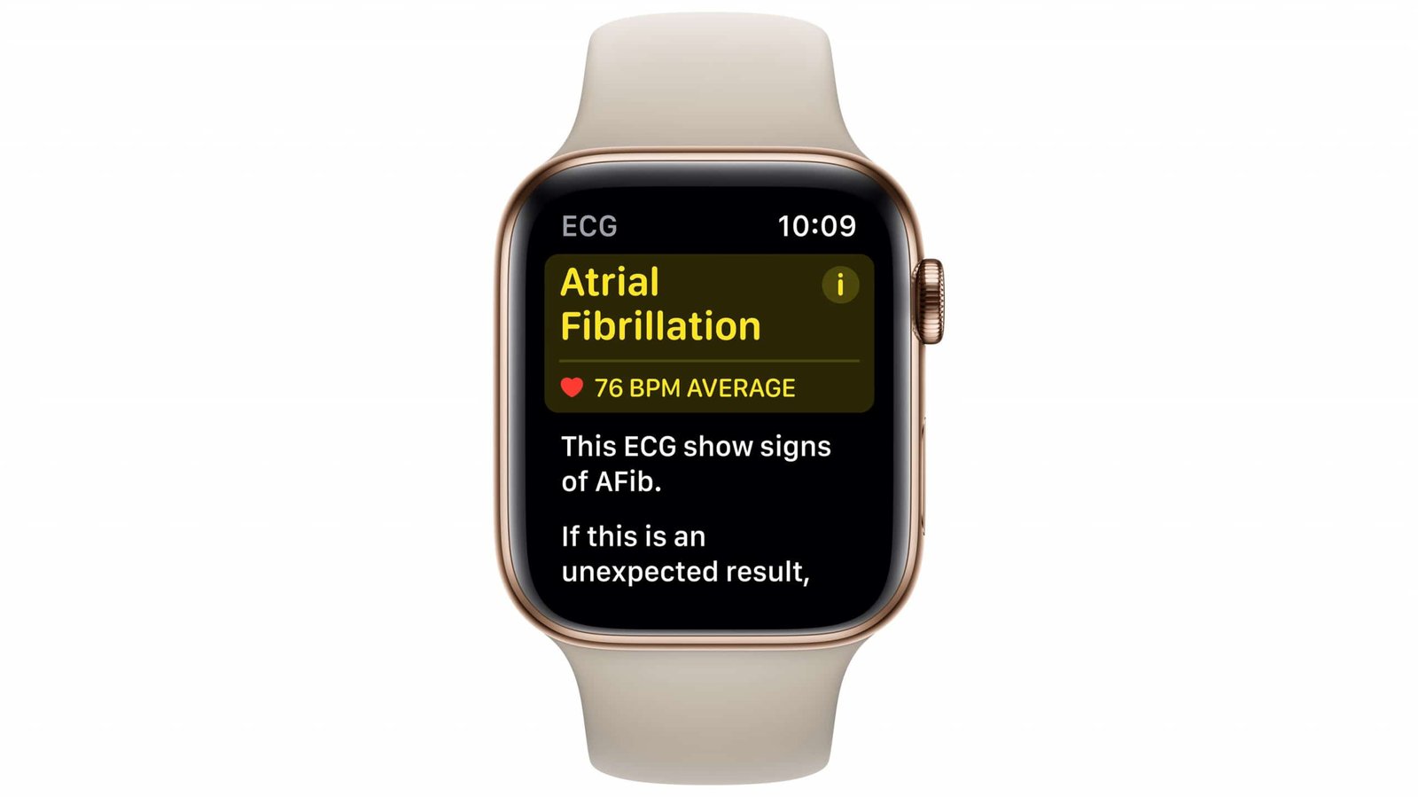 Apple Watch AFib